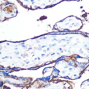 Anti-CD55 antibody produced in rabbit