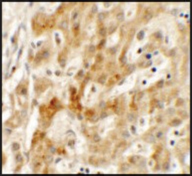 Anti-TMEM106B antibody produced in rabbit affinity isolated antibody