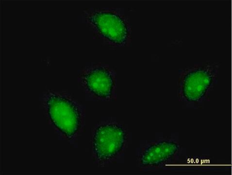 ANTI-FLI1 antibody produced in mouse clone 2G5, purified immunoglobulin, buffered aqueous solution