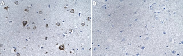 Anti-ATXN2 Antibody, clone 3N14 ZooMAb&#174; Rabbit Monoclonal recombinant, expressed in HEK 293 cells