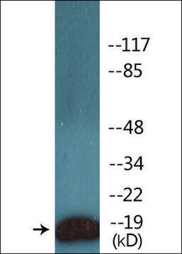 Anti-phospho-CD3 &#950; (pTyr142) antibody produced in rabbit affinity isolated antibody