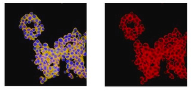 Anti-Olig-2 Antibody from rabbit, purified by affinity chromatography