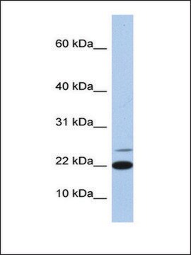 Anti-IL4 antibody produced in rabbit affinity isolated antibody