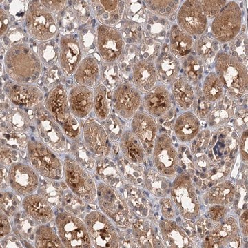 Anti-SNX15 antibody produced in rabbit Prestige Antibodies&#174; Powered by Atlas Antibodies, affinity isolated antibody, buffered aqueous glycerol solution