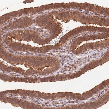 Anti-LRRC43 antibody produced in rabbit Prestige Antibodies&#174; Powered by Atlas Antibodies, affinity isolated antibody, buffered aqueous glycerol solution