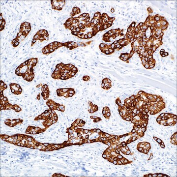 Cytokeratin 5 (EP1601Y) + Cytokeratin 14 (LL002) Mouse and Rabbit Monoclonal Antibody