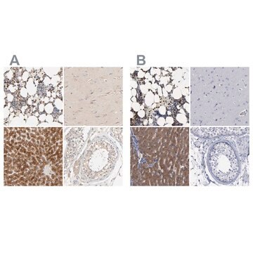 Anti-PYGL antibody produced in rabbit Prestige Antibodies&#174; Powered by Atlas Antibodies, affinity isolated antibody, buffered aqueous glycerol solution