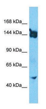 Anti-SLIT3 (N-terminal) antibody produced in rabbit affinity isolated antibody