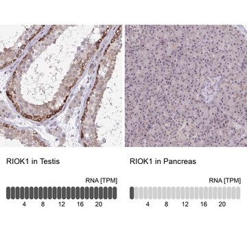 Anti-RIOK1 antibody produced in rabbit Prestige Antibodies&#174; Powered by Atlas Antibodies, affinity isolated antibody, buffered aqueous glycerol solution