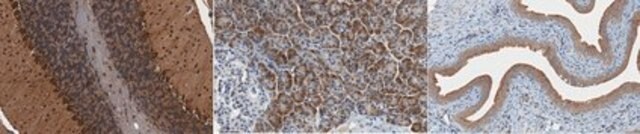 Anti-SGK1 Antibody, clone 1G2.1 clone 1G2.1, from mouse