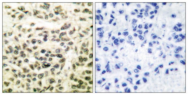 Anti-GSK3 antibody produced in rabbit affinity isolated antibody