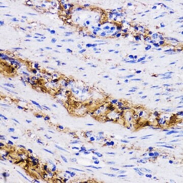 Anti-COL1A1 antibody produced in rabbit