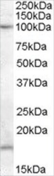 Anti-TEB4/MARCH-VI (AA 701-712) antibody produced in goat affinity isolated antibody, buffered aqueous solution