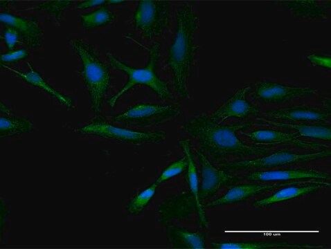 Anti-RARSL antibody produced in mouse purified immunoglobulin, buffered aqueous solution