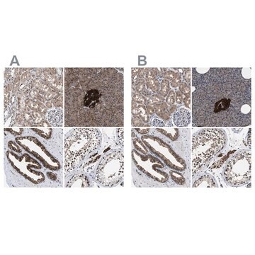 Anti-ACLY antibody produced in rabbit Prestige Antibodies&#174; Powered by Atlas Antibodies, affinity isolated antibody, buffered aqueous glycerol solution, Ab1