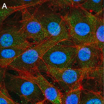 Anti-Treslin Antibody, clone 5L19 ZooMAb&#174; Rabbit Monoclonal recombinant, expressed in HEK 293 cells