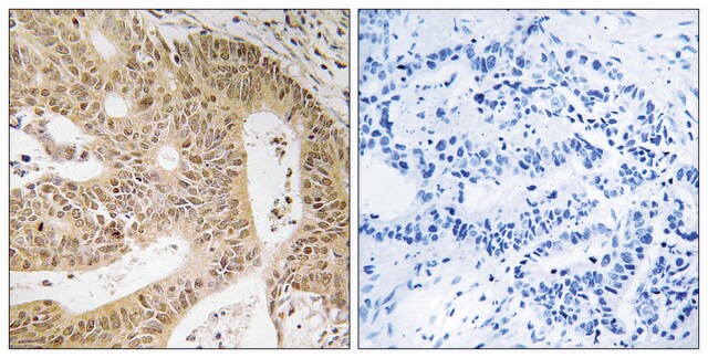 Anti-DAP antibody produced in rabbit affinity isolated antibody