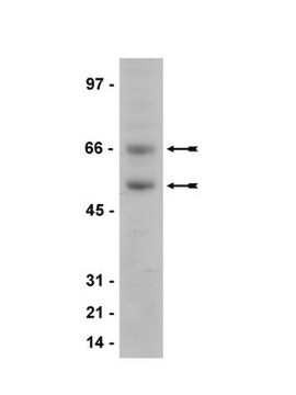 Anti-Meis 1/2/3 Antibody, clone 9.2.7 ascites fluid, clone 9.2.7, Upstate&#174;