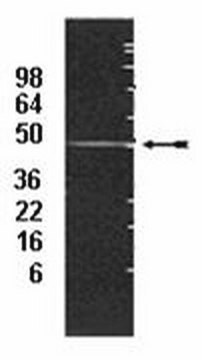 Anti-19S regulator non-ATPase subunit S5a/Rpn10 Antibody, clone S5a-18 clone S5a-18, Upstate&#174;, from mouse