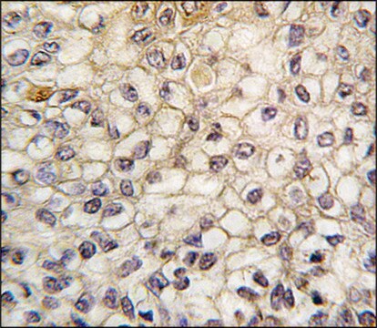 Anti-CYP2F1 (C-term) antibody produced in rabbit saturated ammonium sulfate (SAS) precipitated, buffered aqueous solution