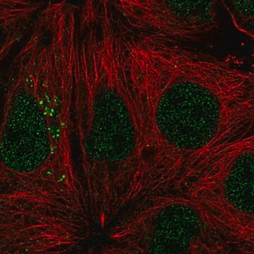 Anti-ST14 antibody produced in rabbit Prestige Antibodies&#174; Powered by Atlas Antibodies, affinity isolated antibody