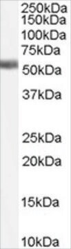 Anti-Farnesoid X Receptor/HRR1 antibody produced in goat affinity isolated antibody, buffered aqueous solution