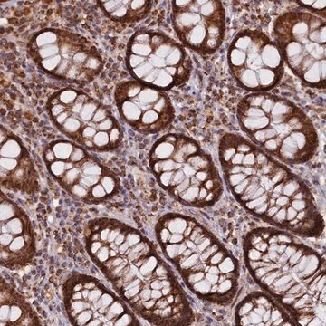 Anti-DUS3L antibody produced in rabbit Prestige Antibodies&#174; Powered by Atlas Antibodies, affinity isolated antibody, buffered aqueous glycerol solution