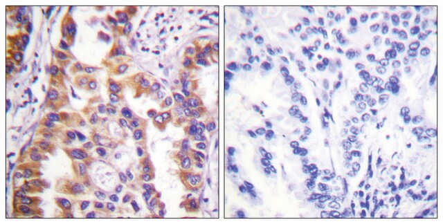 Anti-TSC2 antibody produced in rabbit affinity isolated antibody