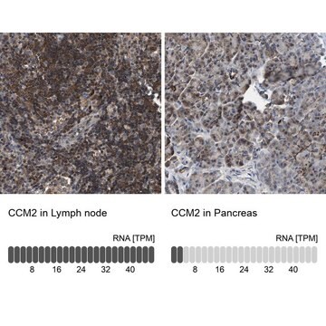 Anti-CCM2 antibody produced in rabbit Prestige Antibodies&#174; Powered by Atlas Antibodies, affinity isolated antibody, buffered aqueous glycerol solution, Ab1