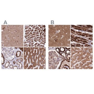 抗ATP5H抗体 ウサギ宿主抗体 Prestige Antibodies&#174; Powered by Atlas Antibodies, affinity isolated antibody, buffered aqueous glycerol solution