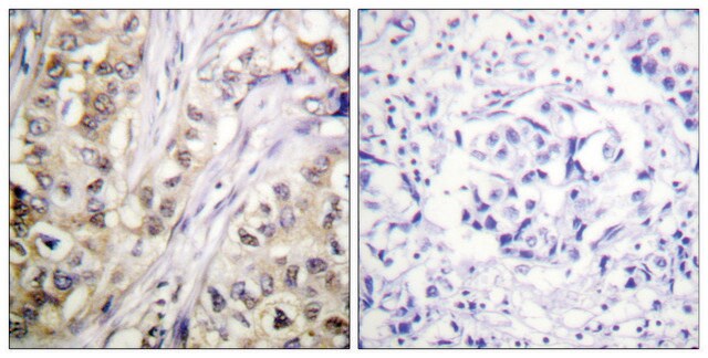 Anti-Survivin antibody produced in rabbit affinity isolated antibody