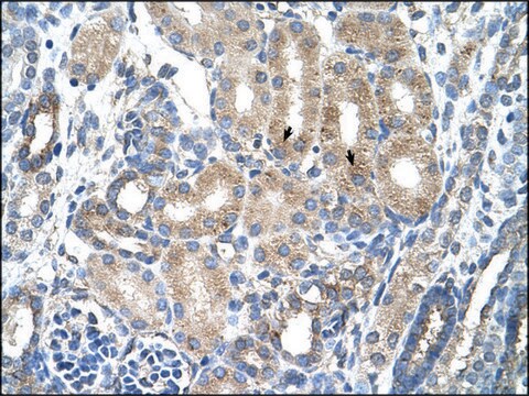 Anti-AGER (AB2) antibody produced in rabbit IgG fraction of antiserum