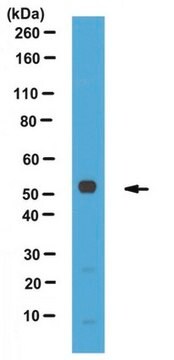 Anti-Perilipin-3, C-terminus Antibody from rabbit, purified by affinity chromatography