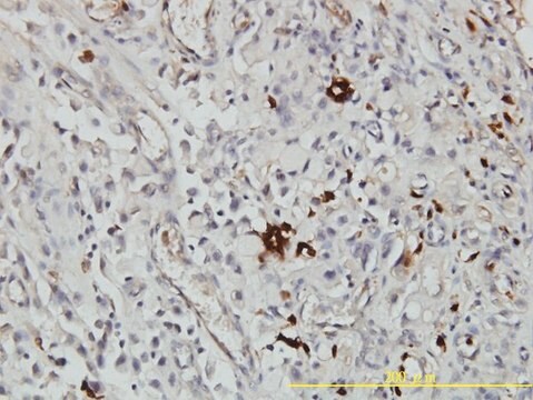 Monoclonal Anti-ORM1 antibody produced in mouse clone 2F9-1F10, purified immunoglobulin, buffered aqueous solution