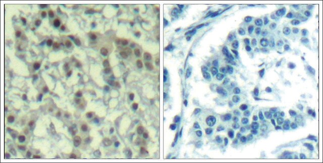 Anti-phospho-AURKA (pThr288) antibody produced in rabbit affinity isolated antibody