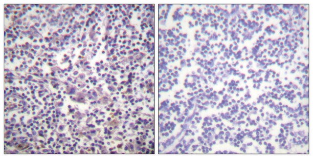 Anti-B-RAF, C-Terminal antibody produced in rabbit affinity isolated antibody