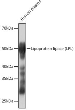 Anti-Lipoprotein lipase (LPL) Antibody, clone 10E10P9, Rabbit Monoclonal