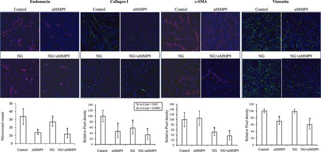 Anti-Endomucin Antibody, clone V.5C7 clone V.5C7, from rat