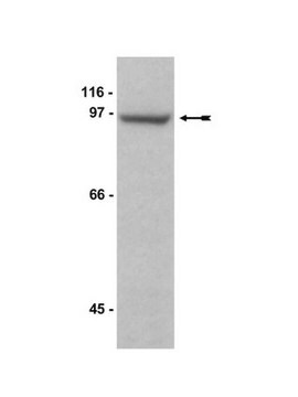 Anti-MAGE-D1/NRAGE Antibody serum, Upstate&#174;