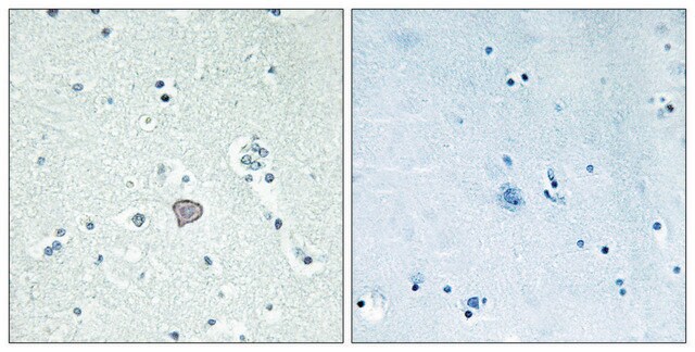 Anti-ADORA2A antibody produced in rabbit affinity isolated antibody