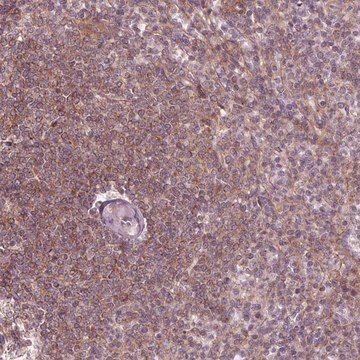 Anti-ADAM33 antibody produced in rabbit Prestige Antibodies&#174; Powered by Atlas Antibodies, affinity isolated antibody, buffered aqueous glycerol solution