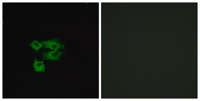 Anti-LY6E antibody produced in rabbit affinity isolated antibody