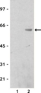 Anti-Calmodulin Binding Protein Epitope Tag Antibody Upstate&#174;, from rabbit