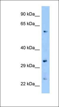 Anti-ZFP664 antibody produced in rabbit affinity isolated antibody