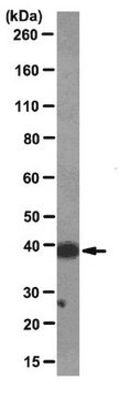 Anti-macro-H2A1.2 Antibody, clone 14G7 clone 14G7, from mouse