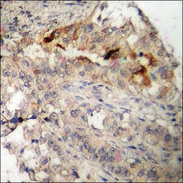 Anti-phospho-Akt1 S1 (pThr246) antibody produced in rabbit affinity isolated antibody