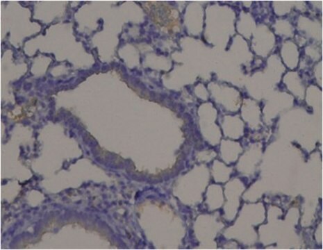 Anti-PXDN/VPO1 Antibody from rabbit, purified by affinity chromatography