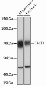 Anti-BACE1 Antibody, clone 7C5T7, Rabbit Monoclonal