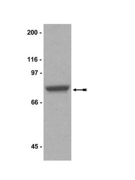 Anti-PRMT5 Antibody Upstate&#174;, from rabbit