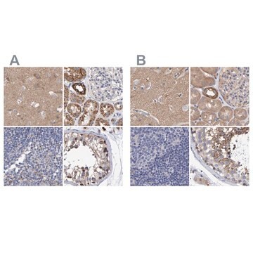 Anti-EFR3A antibody produced in rabbit Prestige Antibodies&#174; Powered by Atlas Antibodies, affinity isolated antibody, buffered aqueous glycerol solution, Ab1